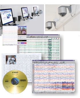 數字化視頻腦電監(jiān)護分析系統