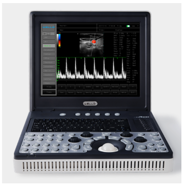 便攜式全數(shù)字彩色多普勒超聲診斷系統(tǒng)d3