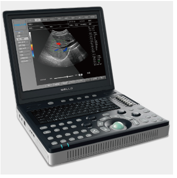 便攜式全數字彩色多普勒超聲診斷系統d6