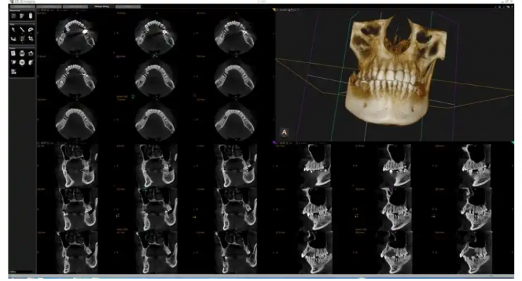 牙科影像存儲(chǔ)與傳輸系統(tǒng)軟件dtx studiotm core
